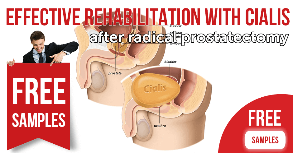 Effective Rehabilitation with Cialis (Tadalafil) After Radical Prostatectomy